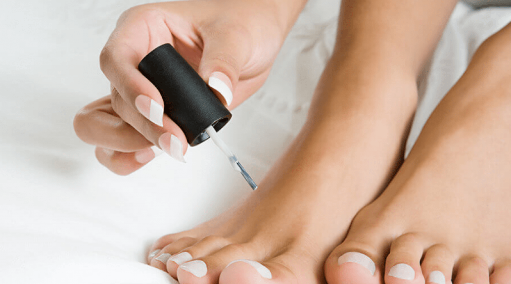 Behandlung von Pilzen am Daumen mit Nagellack