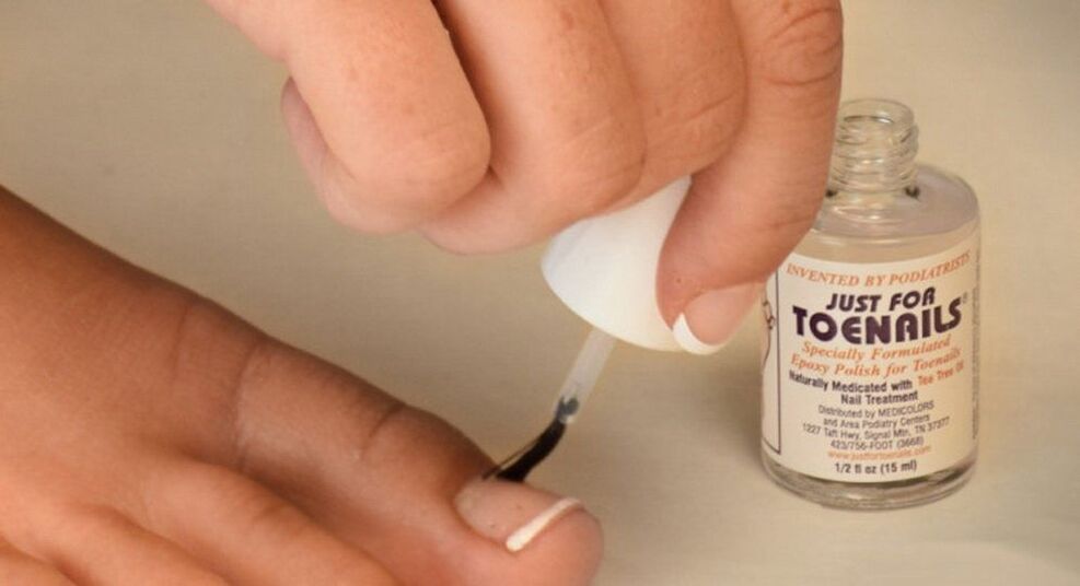 Nagelpilz am großen Zeh
