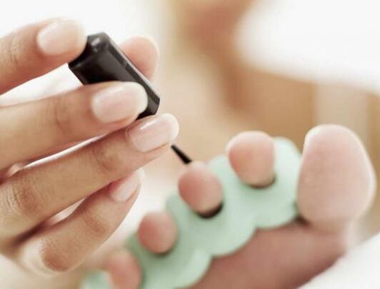 Behandeln Sie Ihre Nägel bei einer Pilzinfektion mit Nagellack