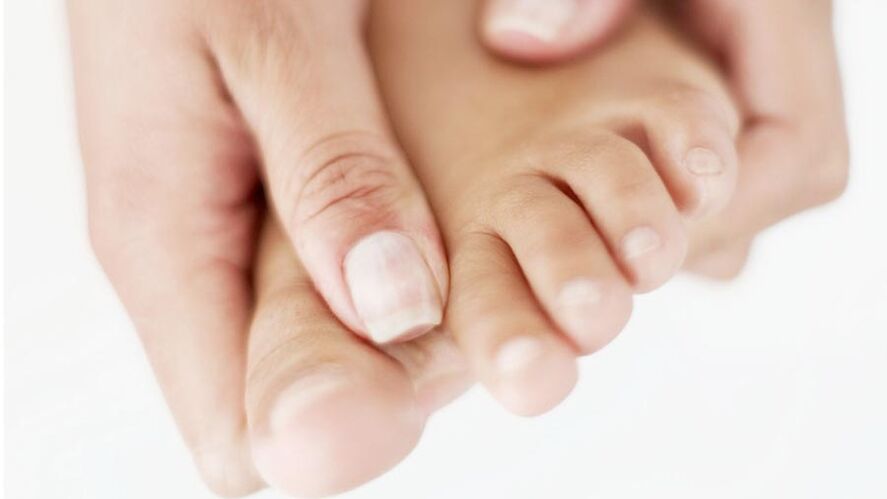 Juckreiz durch Nagelpilz am großen Zeh